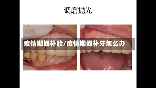 疫情期间补胎/疫情期间补牙怎么办