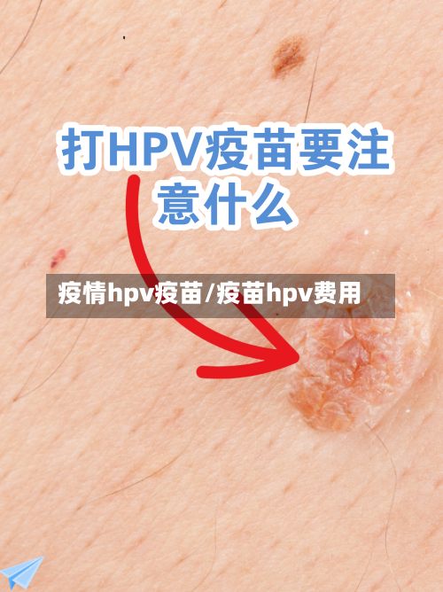 疫情hpv疫苗/疫苗hpv费用