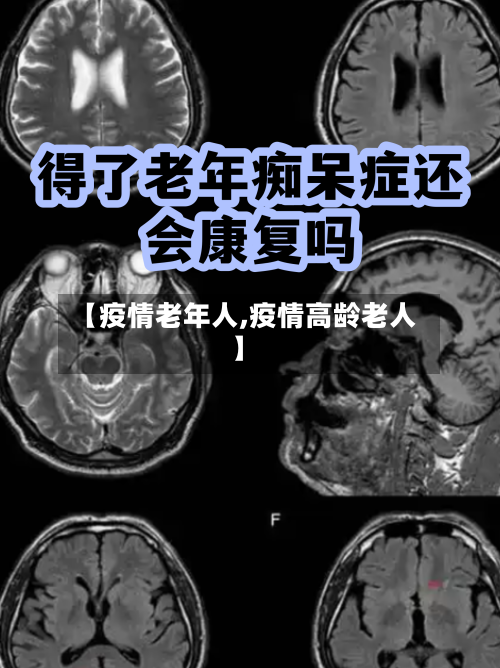 【疫情老年人,疫情高龄老人】