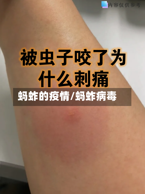 蚂蚱的疫情/蚂蚱病毒