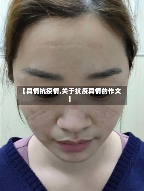 【真情抗疫情,关于抗疫真情的作文】